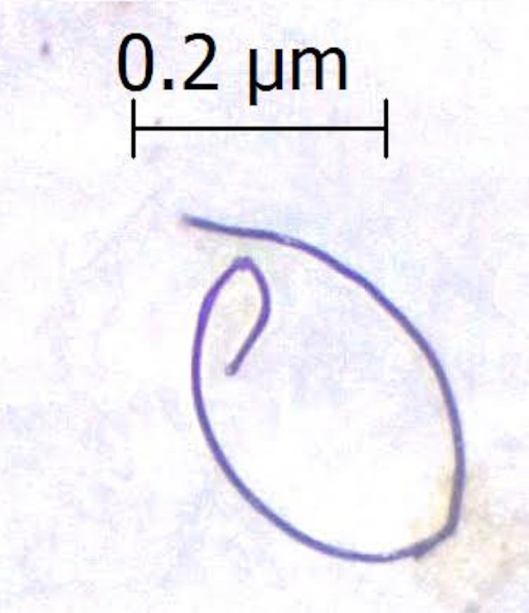 A microsopic image shows a thread-like squiggle of purple. The scale given for the object is 0.2 microns.